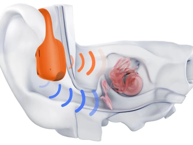 Shokz Bone Conduction Kopfhörer OpenRun Pro 2 USB-C Orange